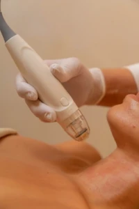 Microneedling Miami: How to Protect Your Skin from Climate