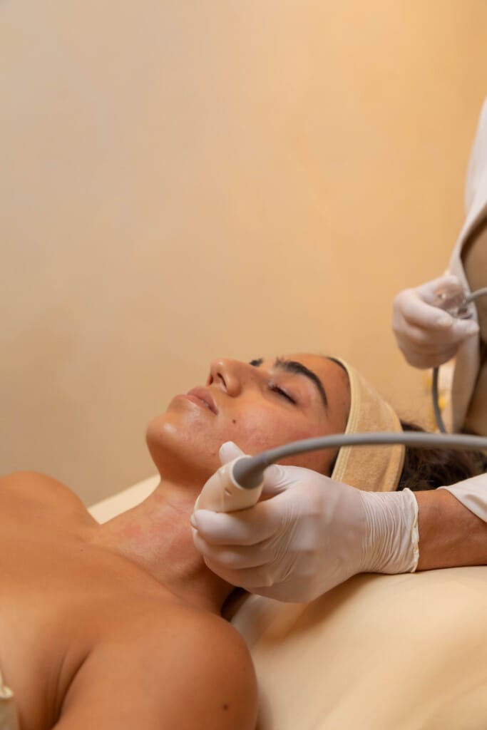 Vivace skin tightening treatment at Zeugma Medspa Miami Edgewater