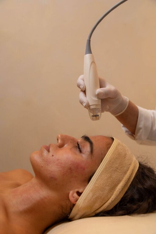 Vivace RF microneedling at Zeugma Medspa Miami Edgewater