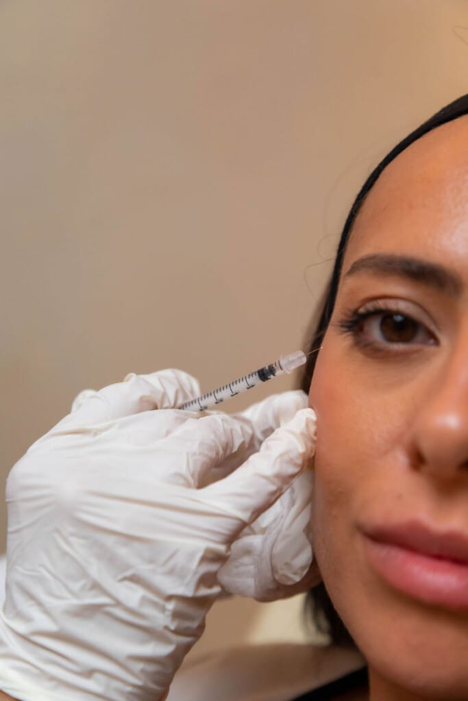 Dermal filler injection at Zeugma Medspa Miami Edgewater