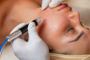 Facial Treatments: The Secret to Radiant, Youthful Skin