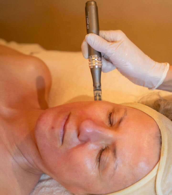 microneedling spa