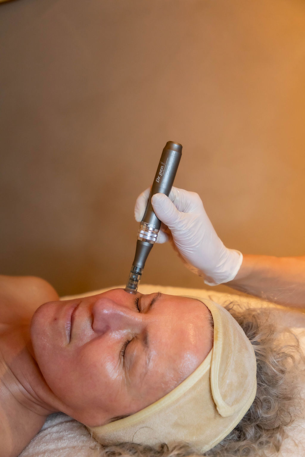 microneedling miami