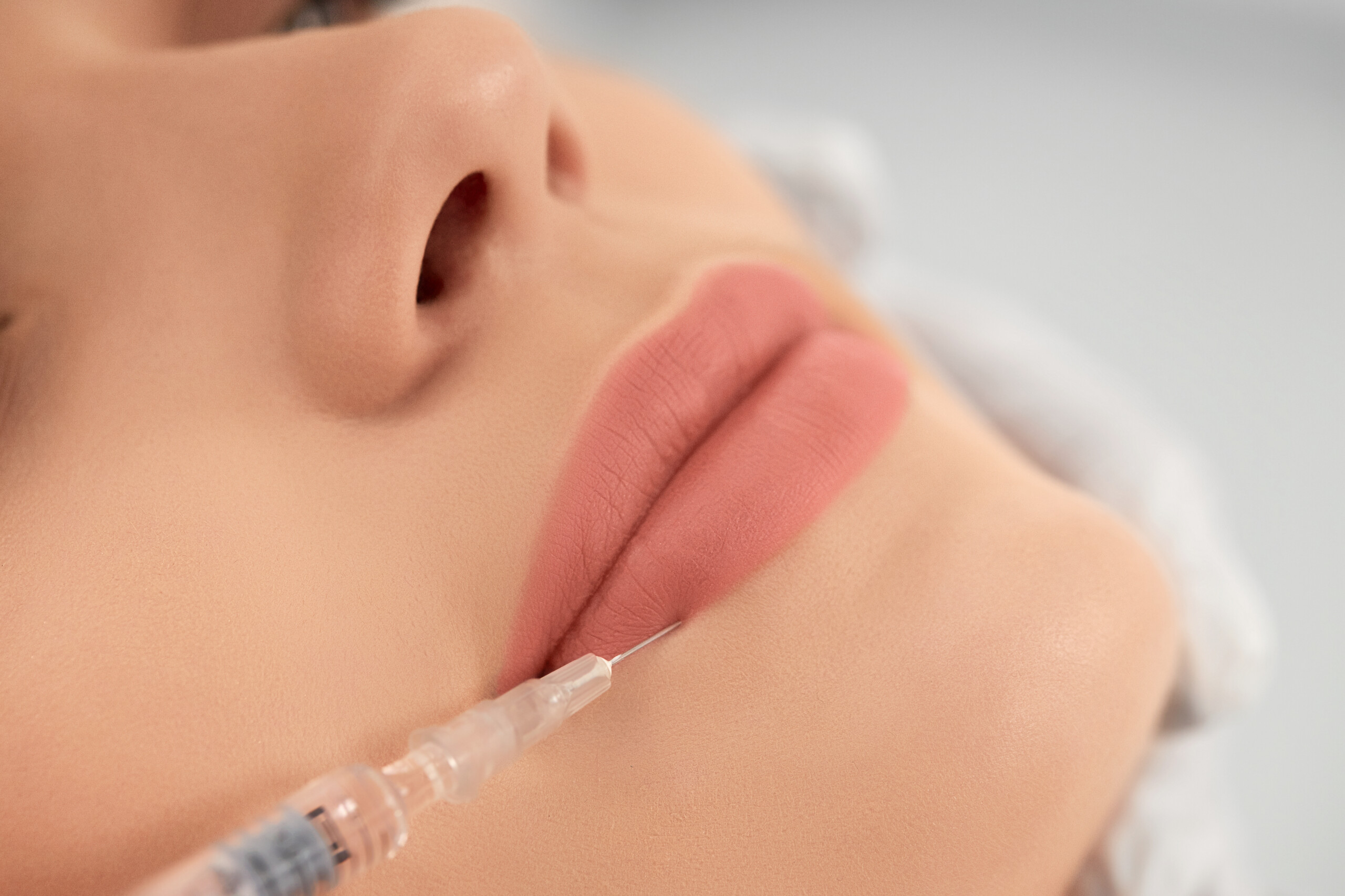 lip fillers zeugma